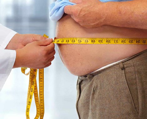 Dr. Aksoy, ‘Obezite sağlıklı yaşam için riks’