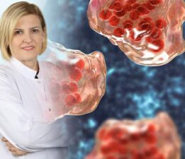 Lösemi hakkında bilinmesi gereken 8 önemli nokta!