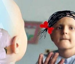 Prof. Dr. Cengiz Canpolat, “Çocuklarda lenf bezlerindeki büyümeye dikkat!”