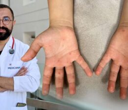 Uzman doktor Hasan Çetinkaya uyardı, “Bu hastalık hafife alınmamalı”