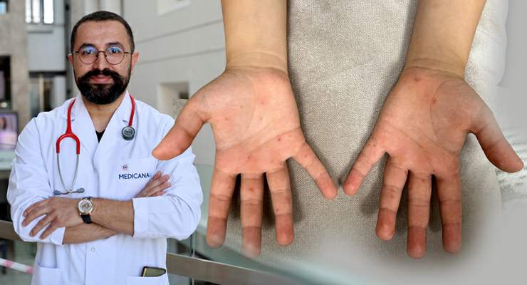 Uzman doktor Hasan Çetinkaya uyardı, “Bu hastalık hafife alınmamalı”