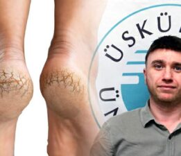 Topuk çatlağını göz ardı etmeyin, enfeksiyonlara davetiye çıkarıyor!