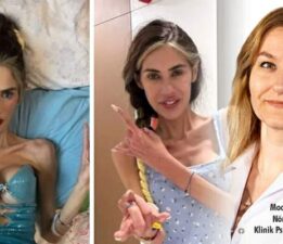 Beste Hasırcı, “Anoreksiya basit bir yeme sorunu değil, Yardım çağrısıdır”