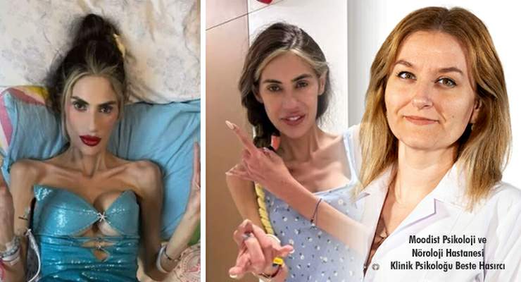 Beste Hasırcı, “Anoreksiya basit bir yeme sorunu değil, Yardım çağrısıdır”
