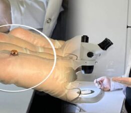 Prof. Dr. Keskin, “Keneyi strese sokacak uygulamalardan kaçınalım”