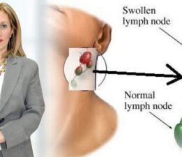 Doç. Dr. Hatice Terzi, “Lenfoma tedavi edilebilir bir kanser türüdür”