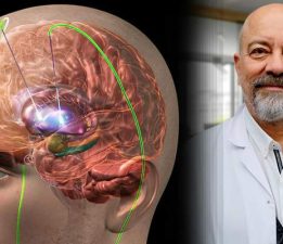 Parkinson hastalığı tedavisinde “Beyin Pili” yöntemi