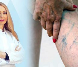 Uzman Dr. Arzu Ercan, “Bacaklarda geçmeyen şişlik ve ağrılara dikkat”