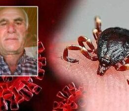 Tokat’ta KKKA tedavisi gören bir kişi hayatını kaybetti
